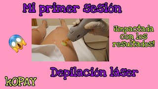 Depilación  láser KOPAY ¿ahora si me sirvió ¿vale la pena primer sesión.