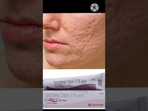 15gm tazret forte tazarotene cream, 0.1% w/w