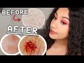 MY ALLERGIC TO WATER SKIN AFTER A BATH MICROSCOPE FOOTAGE Niah Selway