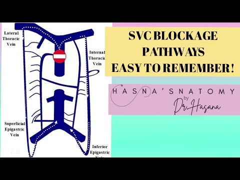 Superior Vena Caval Blockage EXPLAINED | Before & After Azygos Entry | Concept Cleared
