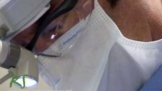 How Nose Surgery is Performed