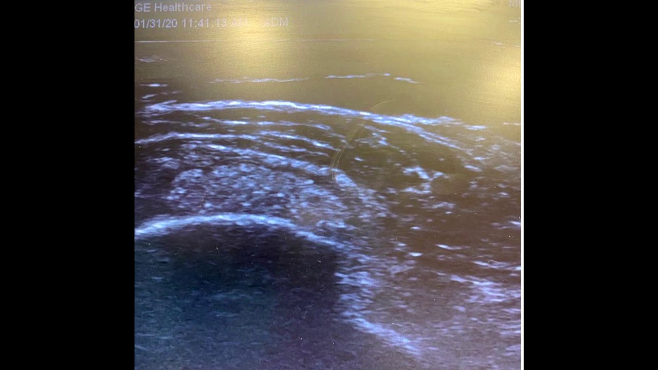 Jorge Camacho Chacon-7