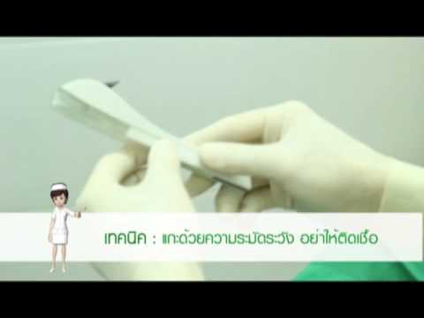 ซีดาร์ในโรคสะเก็ดเงิน การเยียวยาชาวบ้านกลากบนฝ่ามือ