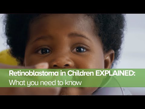 Retinoblastoma in Children EXPLAINED: What you need to know
