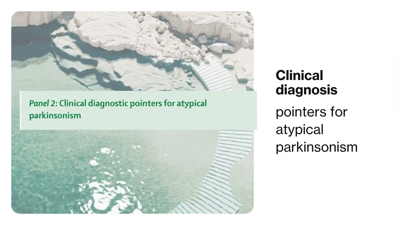 Challenges in the diagnosis of Parkinson's disease