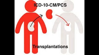 Transplantation Procedures ICD-10-CM/PCS