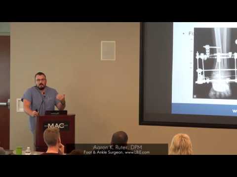 Dr. Aaron Ruter Discusses Muscle Flaps, Ankle Fusion, and External Fixation