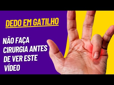 Como tratar o Dedo em Gatilho