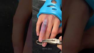 Removing a Stuck Ring + DIY Upcycling Idea 🔥