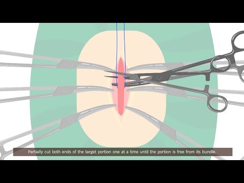 Teaching Videos for Muscle Biopsy, Fixation, and Transportation