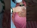 Intramuscular Injection Vlog