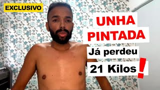 Unha Pintada perde 21 Kg por problemas de saúde