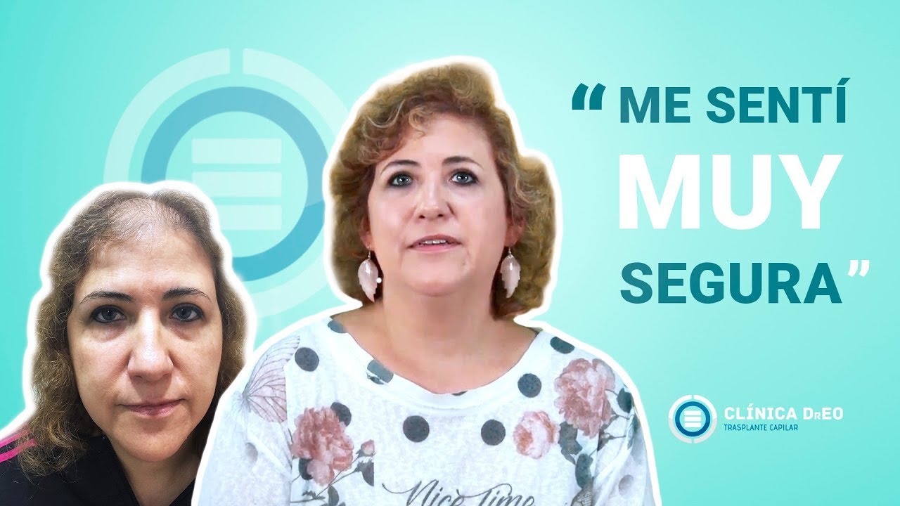 Injerto de cabello en Mujeres. Antes y Después Tratamiento Alopecia