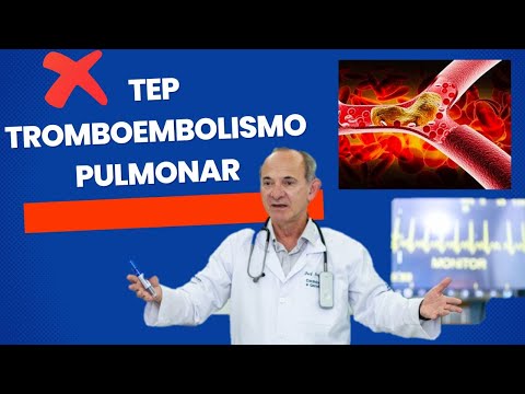TEP Embolia Pulmonar - Aprenda tudo sobre Tromboembolismo Pulmonar