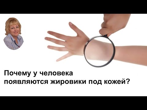 Почему у человека появляются жировики под кожей?