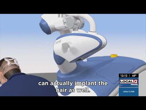 Introducing Artas Robot iXi: The Future of Hair Transplants at Advanced Cosmetic Surgery