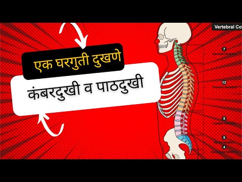 Lower back pain /Sciatica - Specklin Superspeciality Centre