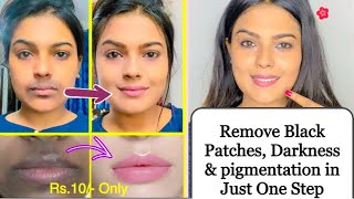 REMOVE DARKNESS AROUND MOUTH AT HOME || Remove With 1 Step Mouth Dark patches & Pigmentation