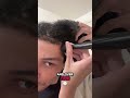 If your going bald it may not be genetics #balding #thinning #recedinghairline #curlyhairproblems