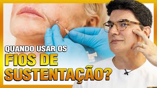 Quando usar os Fio de Sustentação?