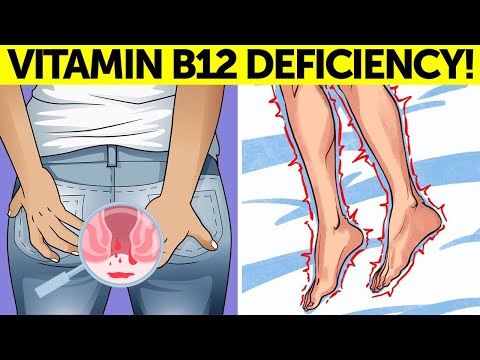8 STRANGE Signs Your Body Is Begging for VITAMIN B12