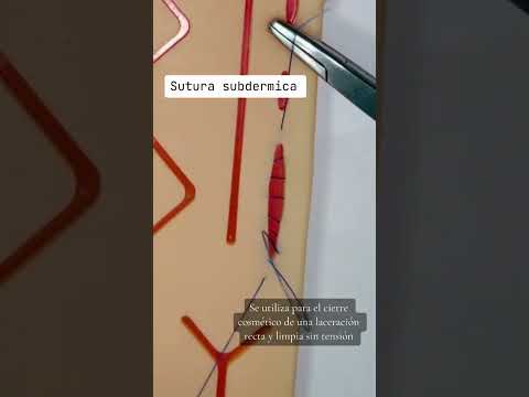 Sutura subdermica #suturas