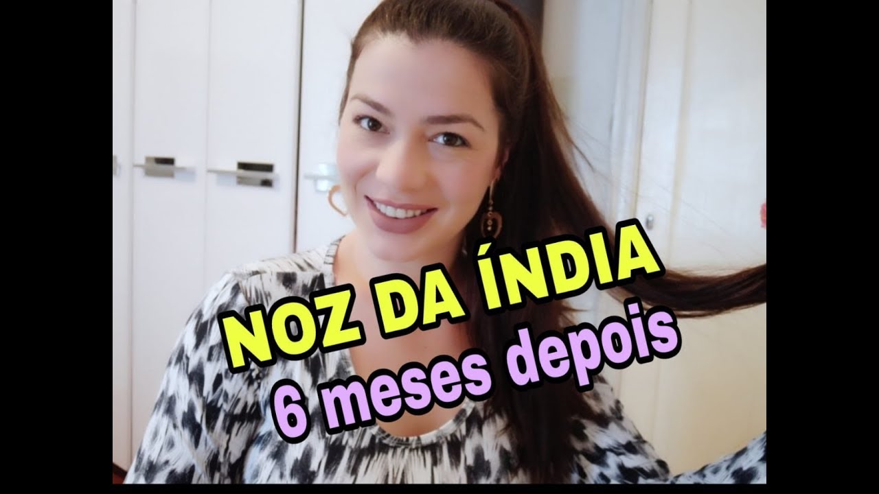 Watch Now NOZ DA ÍNDIA MEU RESULTADO APÓS MESES SERÁ QUE EMAGRECI. NOZ DA ÍNDIA MEU RESULTADO APÓS MESES SERÁ QUE EMAGRECI.