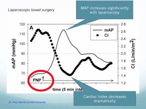 NICOM Rationale and Cost Benefit Discussion