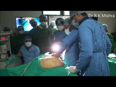Lida tabletas sa Mariupol Slimming lalaki