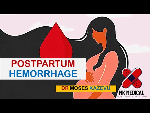 Postpartum hemorrhage || PPH