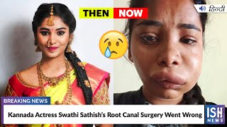Kannada Actress Swathi Sathish’s Root Canal Surgery Went Wrong