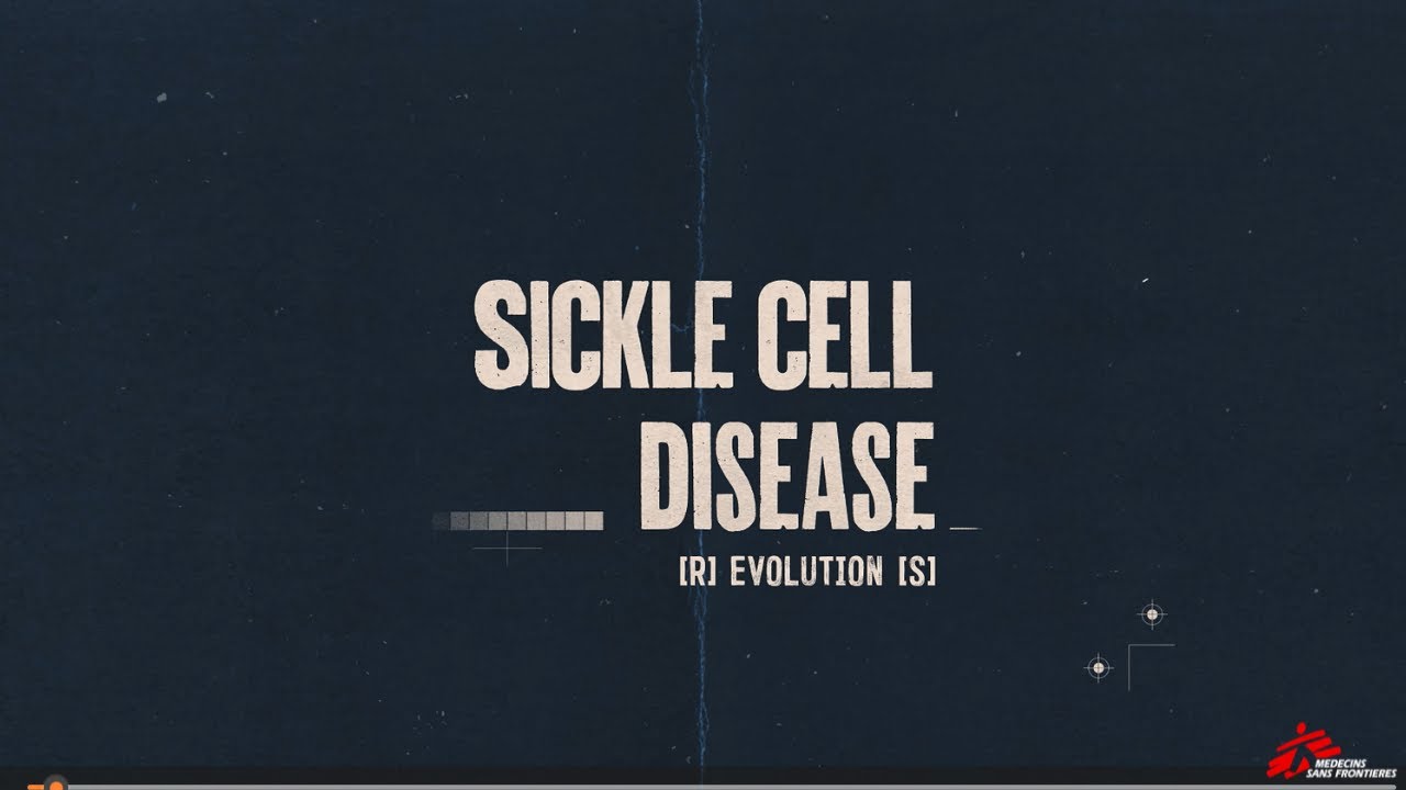 Sickle Cell Disease: The Forgotten Childhood Killer