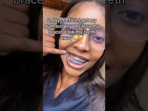 How Your Gums Can TAKE OVER Your Teeth! 😳🦷