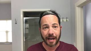 .03 Poly Hairline Redo Real Time Quick and Easy