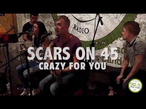 Scars On 45 perform 