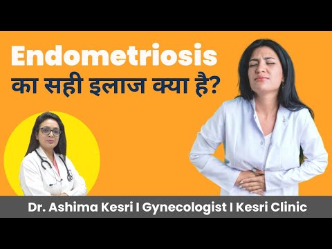 ✅ Endometriosis(Chocolate Cyst) का सही इलाज क्या है? I ✅ Endometriosis Treatment I Dr. Ashima Kesri
