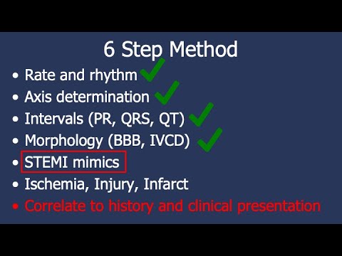 6-Step Method for 12-Lead ECG Interpretation