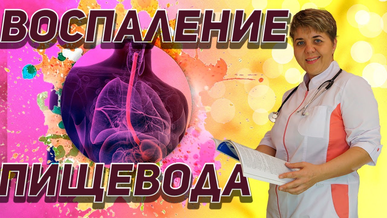 💊 ВОСПАЛЕНИЕ ПИЩЕВОДА 🔴 Причины эзофагита Симптомы 🔴 Профилактика ✅
