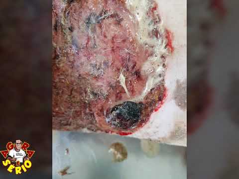 Cachorrinha Fortaleza já passou por uma cirurgia e já tem um novo lar graça a equipe das Protetoras do Grupo AMOR ANIMAL do Facebook que puder ajudar com doações fiquem a vontade.