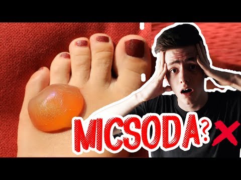 az erekció során a fej nem nyílik ki teljesen kólika az erekció során
