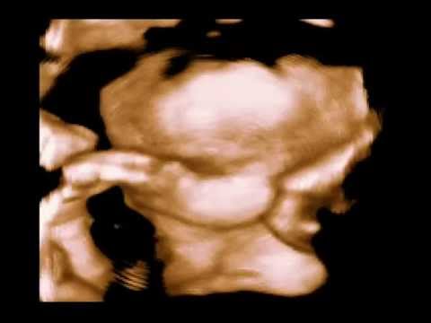 Vores baby - de første billeder