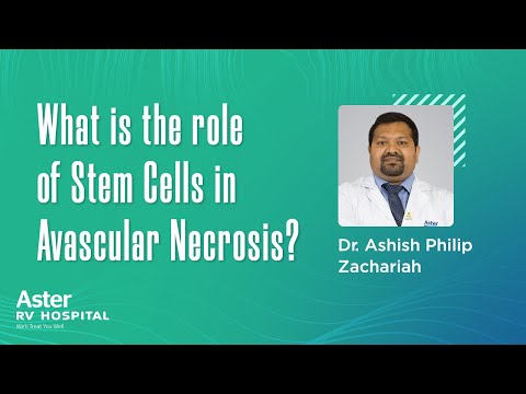 What is the role of Stem Cells in Avascular Necrosis? Dr Ashish Philip Z - Aster RV Hospital