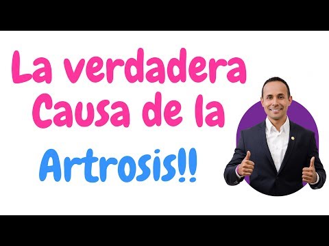 LA VERDADERA CAUSA DE LA ARTROSIS