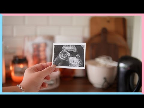 Gender Reveal 🎀 vi avslöjar om det blir en pojke eller flicka 👶🏼 gravid i vecka 20 ✨