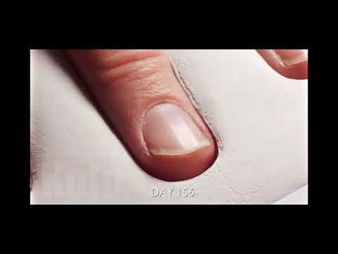 365 Day Time-Lapse of Growing fingernail