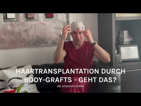 S-thetic Hair: Haartransplantation durch Body Grafts - geht das?