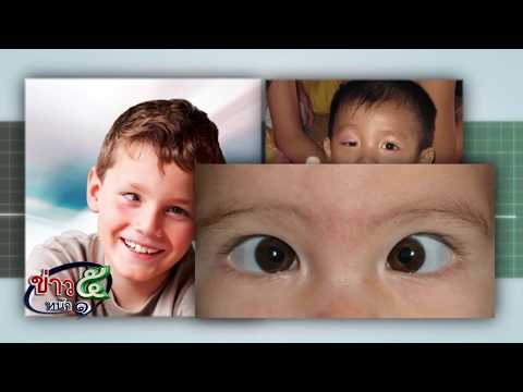 ครีม clotrimazole สำหรับอวัยวะเพศชาย ผมสามารถที่จะเพิ่มสมาชิกใน
