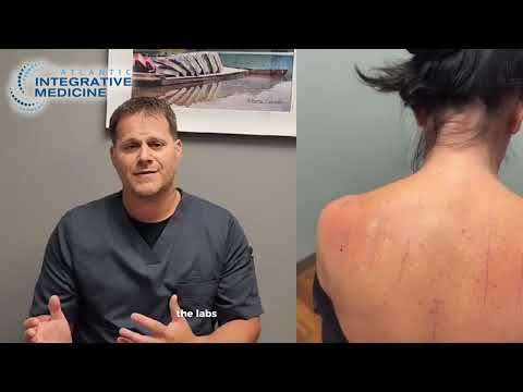 Allergies Explained | Allergy testing & Treatment