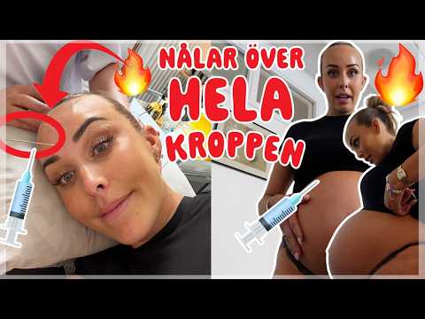 SJUKASTE BEHANDLINGEN JAG NÅGONSIN GJORT!!!