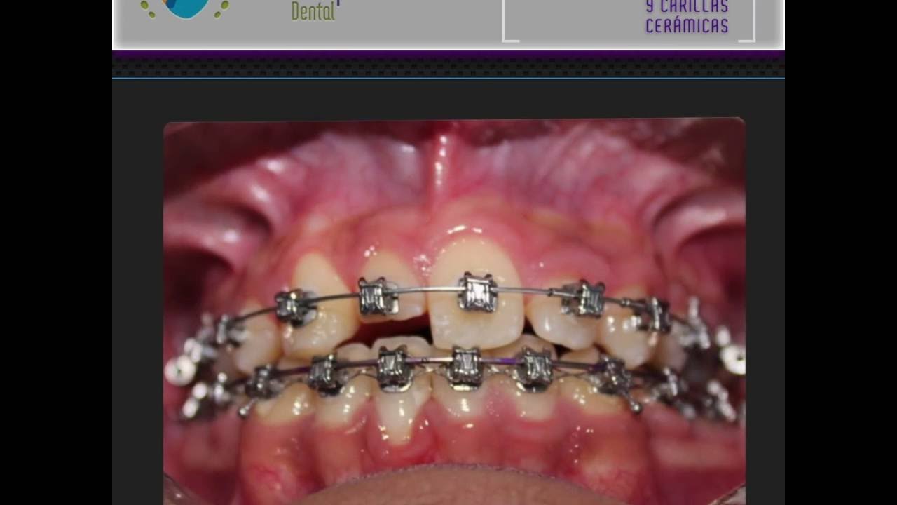 Joaquín Canseco Lopez-9